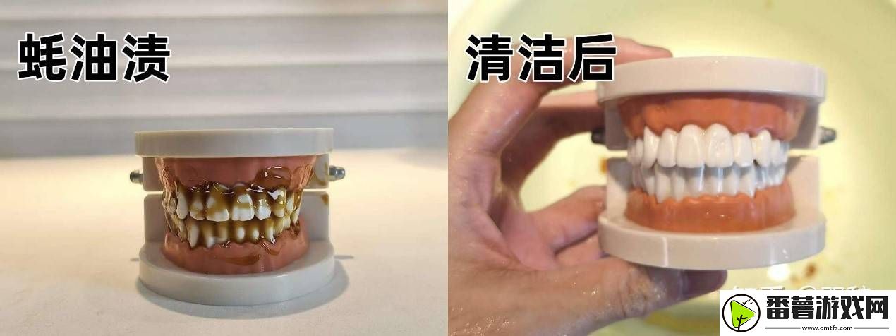 2025年口腔护理新宠!知乎大咖力荐欧可林airpump