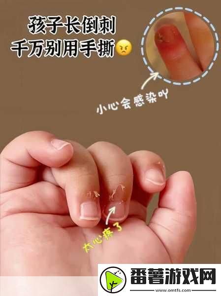 宝宝怎么才三根手指就痛