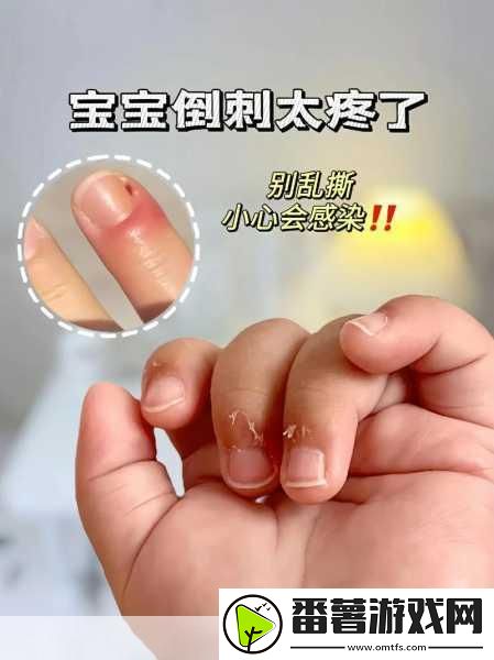 宝宝怎么才三根手指就痛-1.-宝宝为何三根手指就感到疼痛的原因分析