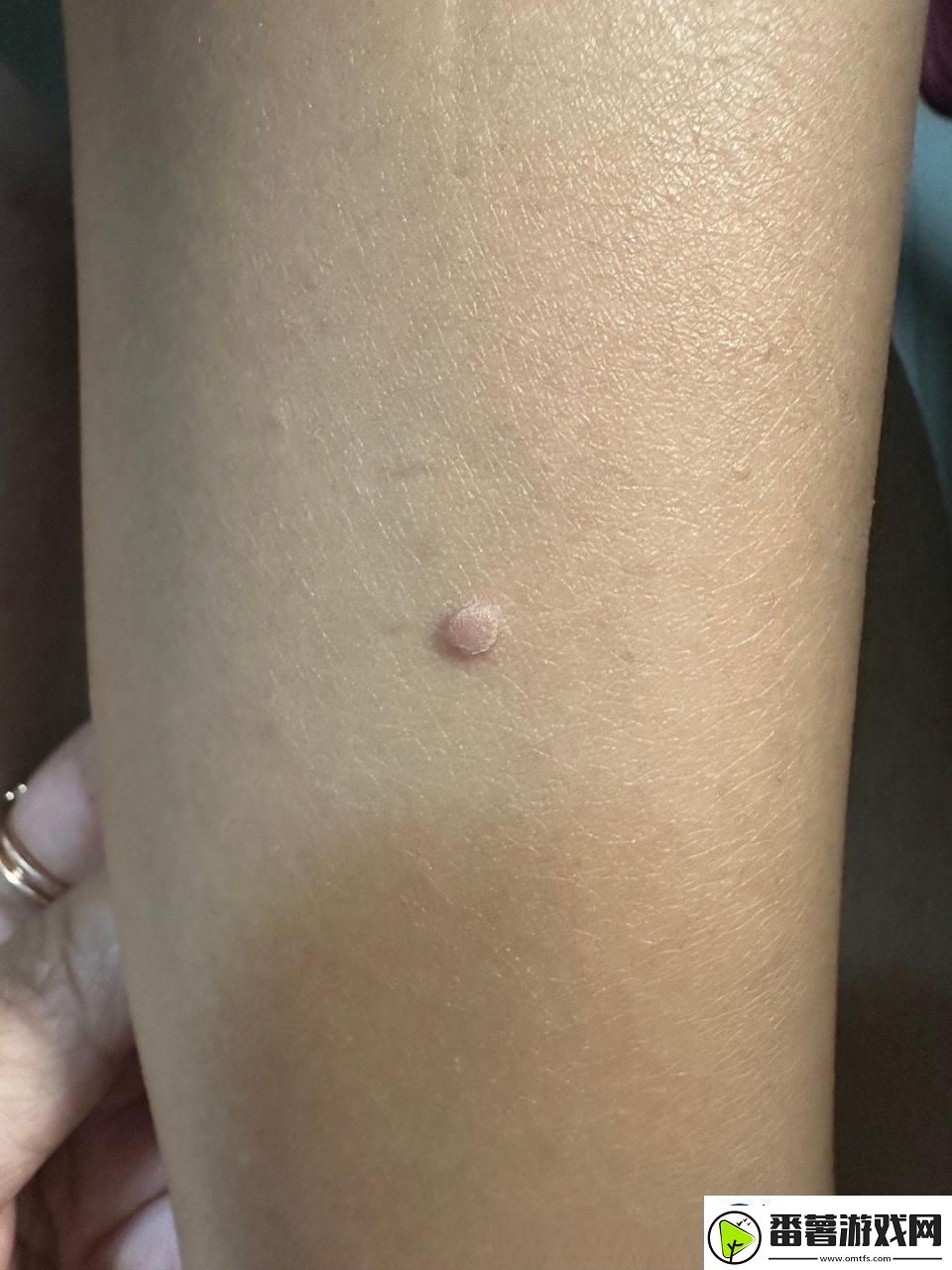 疙瘩里头硬邦邦