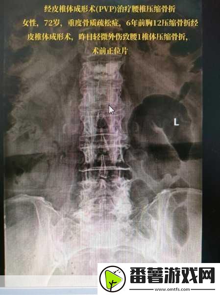 龙之谷手游狙翔