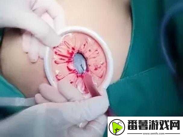 腹部灌满隆起精液令人震撼的奇特景象